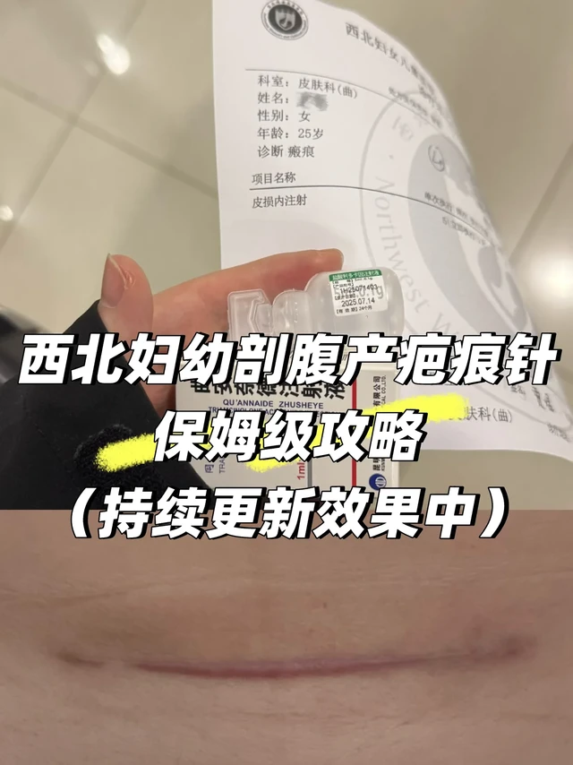 产后恢复｜剖腹产疤痕💉分享❗️