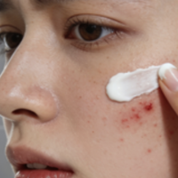 什么成分对痘印修复好?8款去痘印产品口碑推荐:持证淡印更安心