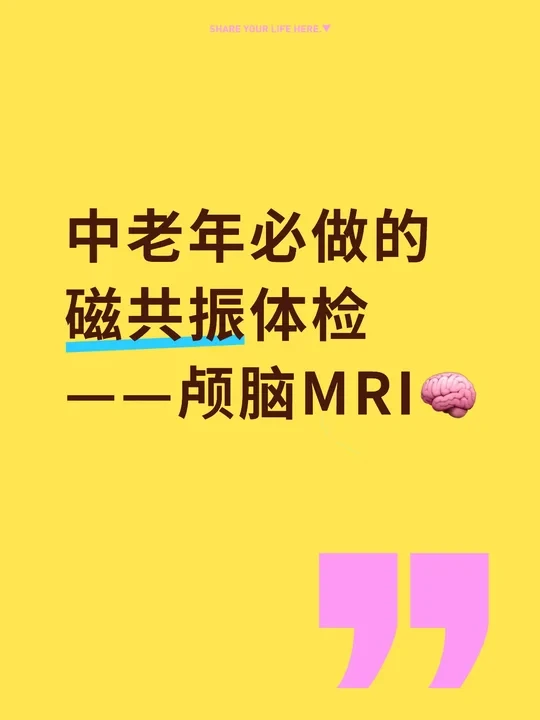 中老年必做的磁共振体检——颅脑MRI🧠
