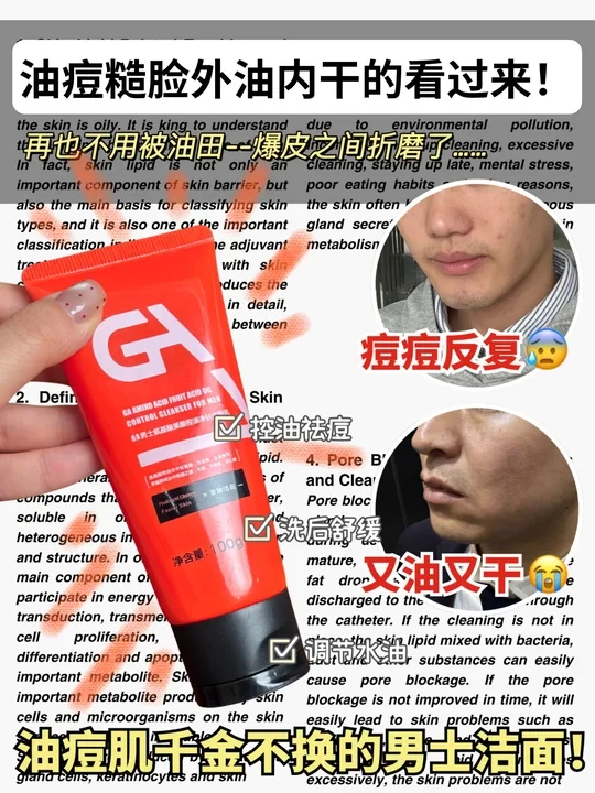 信息差！！冬季油痘肌千金不换的男士洁面！