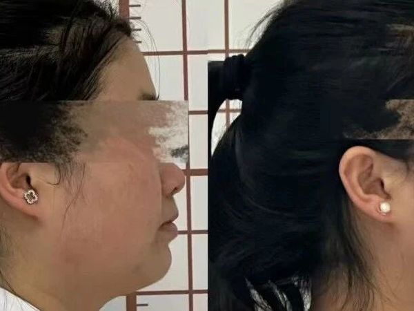 夏日科学减重计划