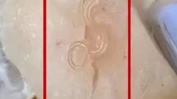 宝宝鳕鱼惊现「寄生虫」！品牌方花钱「堵嘴」？