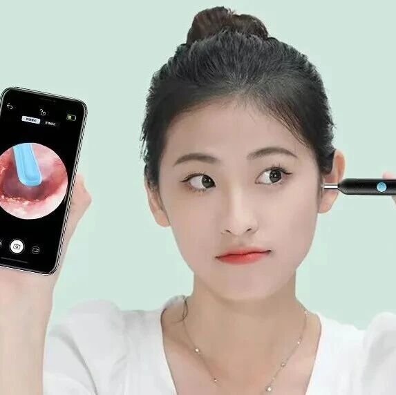 别再用棉签了！黑科技可视掏耳朵神器来了，更舒服，更安全！一家老小都适用