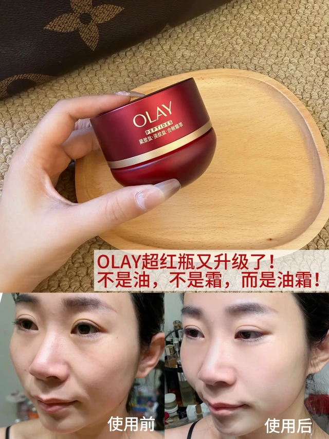 10年干皮！秋冬换季大干皮有救了！