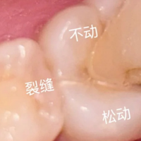 为什么很多人宁愿去洗牙也不愿意用牙粉？深扒牙粉真相！