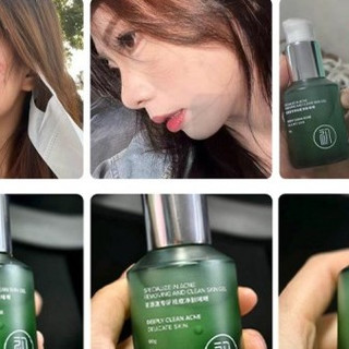 祛痘效果最好的排名第一！学生祛痘产品推荐，好用的祛痘精华