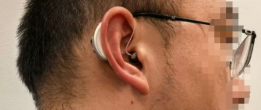 听力损伤会逐渐严重到耳聋嘛？助听器有必要吗？