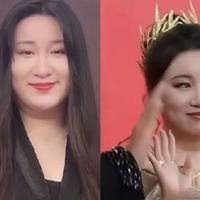 锤娜丽莎为治病减重30斤，重度脂肪肝从32%降至8%