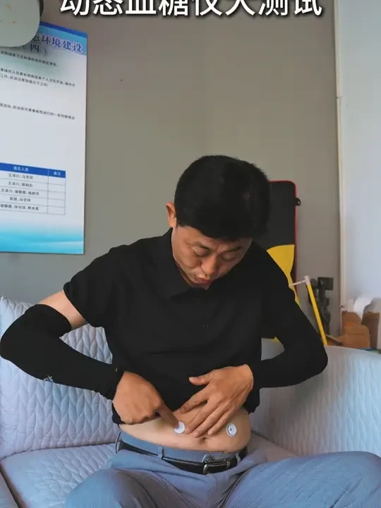 动态血糖仪大比拼 同时佩戴三款主流动态血糖仪，看看哪一款更为准确#糖尿病 #动态血糖仪准不准