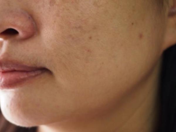 一个淡斑、提气色巨牛的好东西，每天 1 分钟就有用