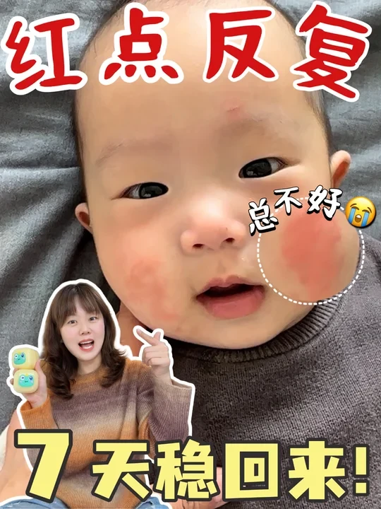 告别红点反复‼️方法在这💡