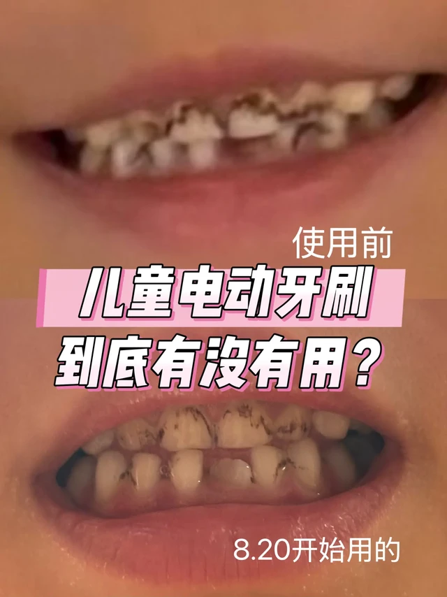 儿童电动牙刷超真实测评