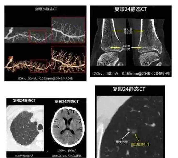 中青年体检