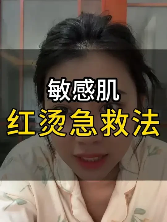 敏感肌红烫急“救”法 #敏感肌#拯救敏感肌#护肤分享#大红脸#不洗脸