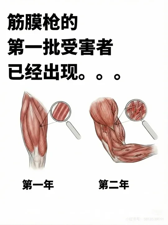 筋膜枪最大的坑，是你以为它“差不多”