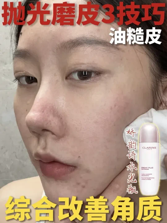 抛光水爆改出油闭口暗沉（油皮护肤跟练！