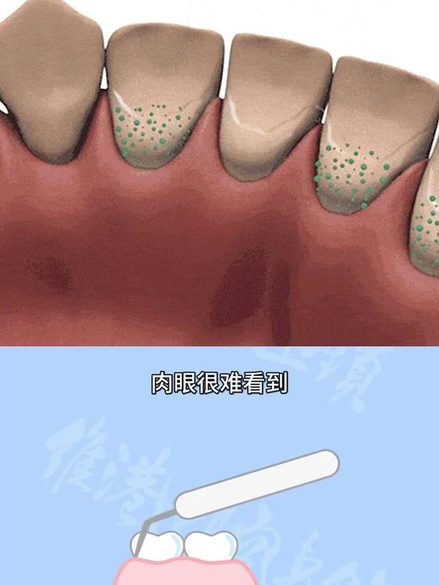 哪款电动牙刷性价比比较高？