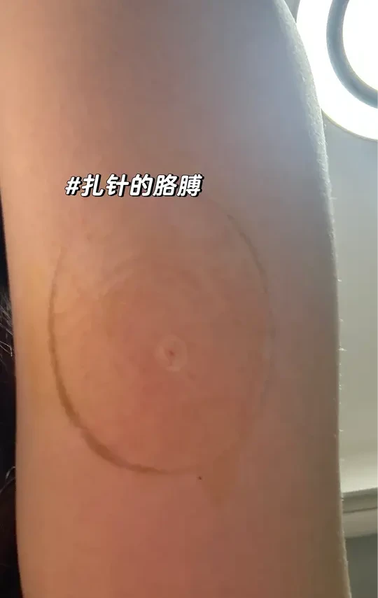 动态血糖仪测评