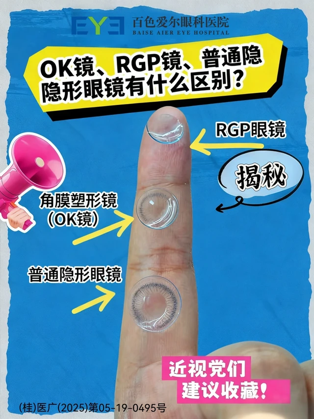 💥OK镜、RGP镜、普通隐形眼镜有什么区别