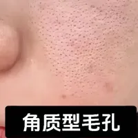 毛孔堵塞粗大？四步科学清洁与疏通法