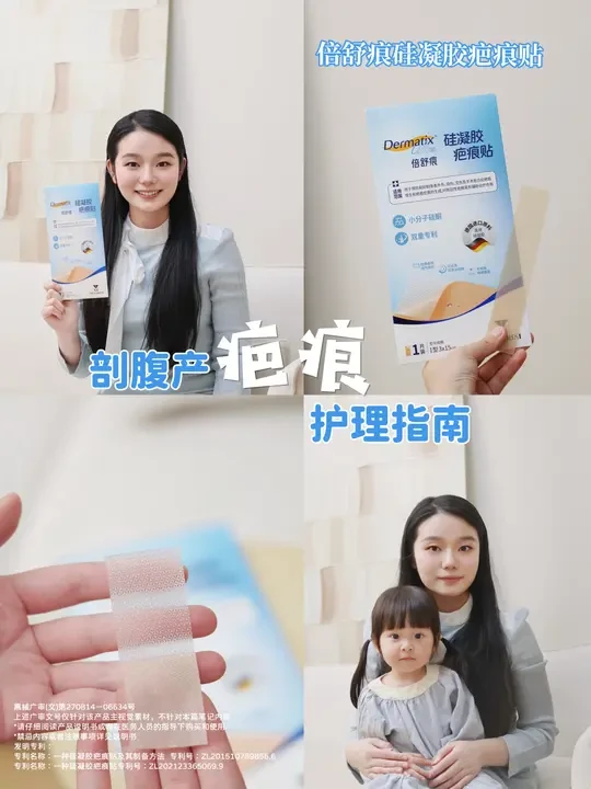 剖腹产妈妈救星！倍舒痕把腹疤“藏”起来了