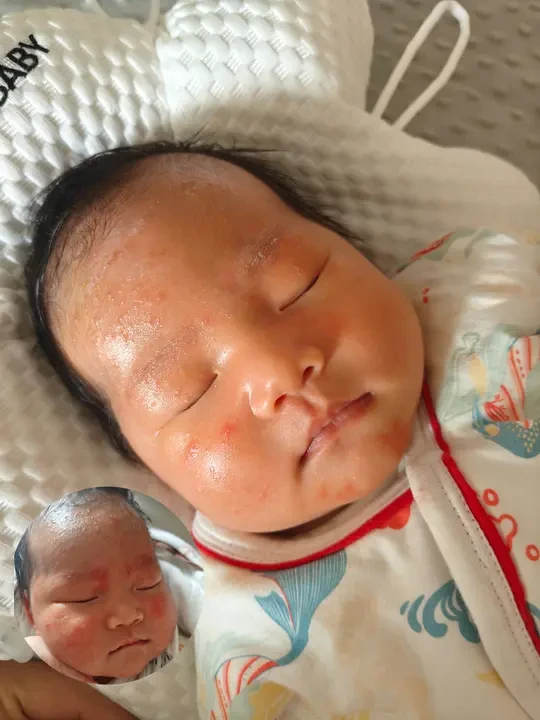 终于找到对付宝宝湿疹的安心办法了！