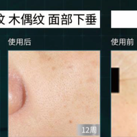 2026口碑爆棚的平价抗老面霜｜年轻肌抗老不花冤枉钱