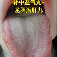 辨清体质再用药：补中益气丸的三种黄金搭配