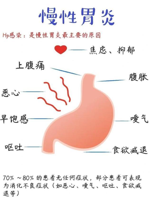 慢性胃炎的用药指导与日常预防管理