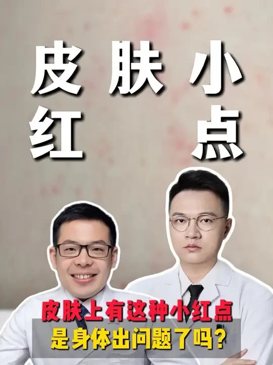 皮肤这些小红点，预示着身体出问题了吗？#抖出健康知识宝藏 #我的年度健康盘点 #医疗健康创作训练营