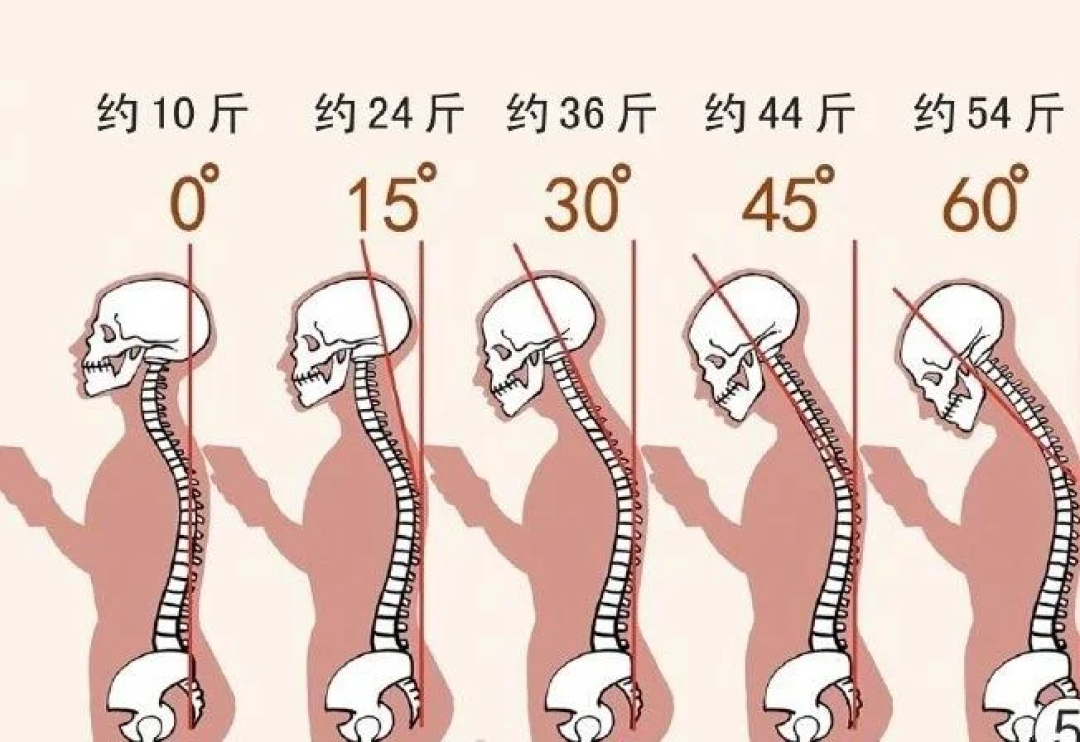 科学护颈:为什么不能随便按摩