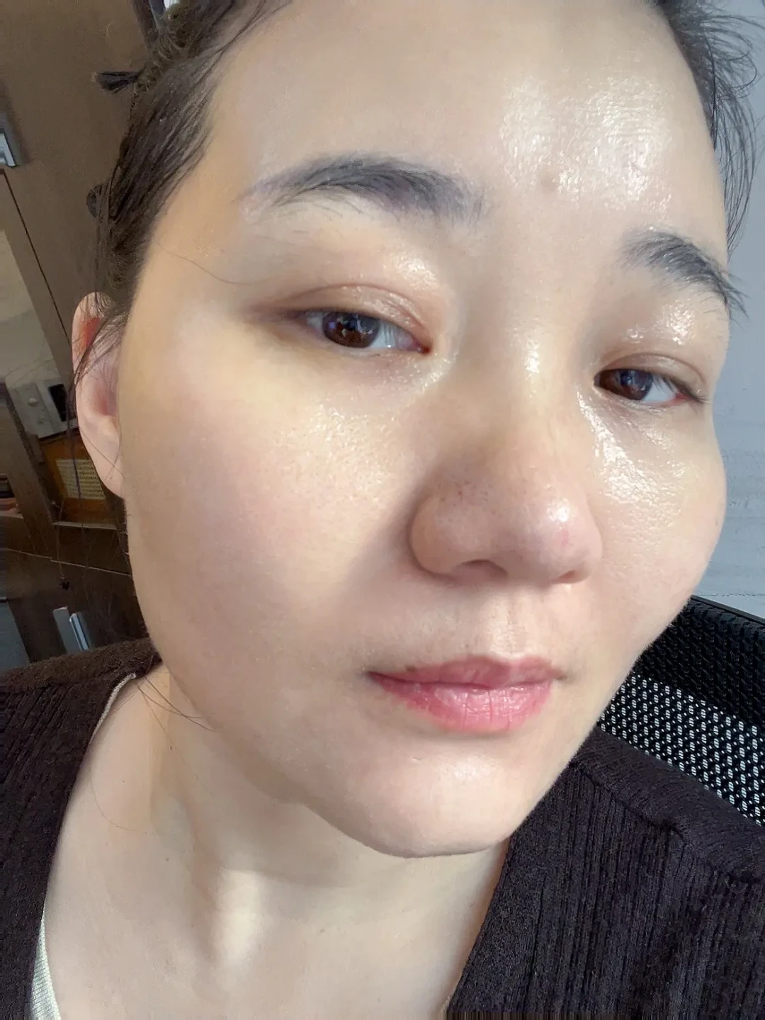 告别反复烂脸，这套抗炎护肤法值得尝试