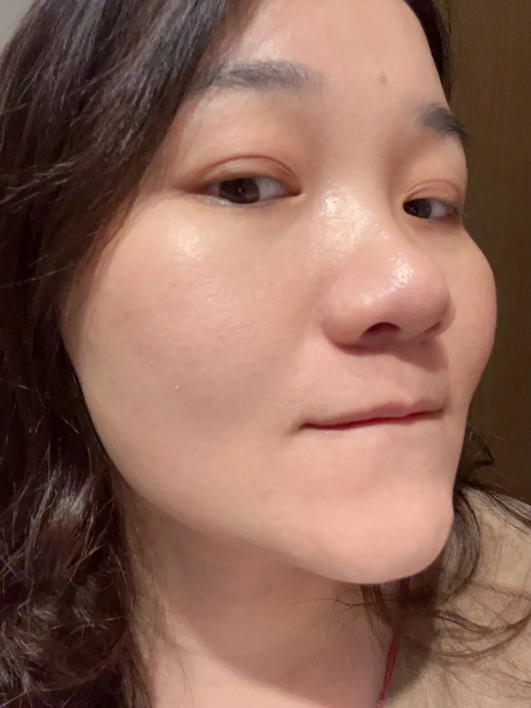 告别反复烂脸，这套抗炎护肤法值得尝试