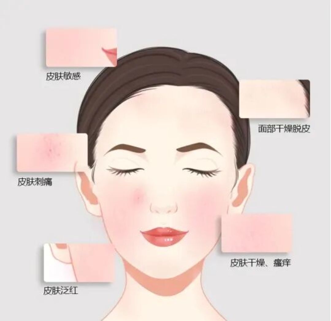 皮肤动不动就脸红?科学重塑肌肤屏障指南