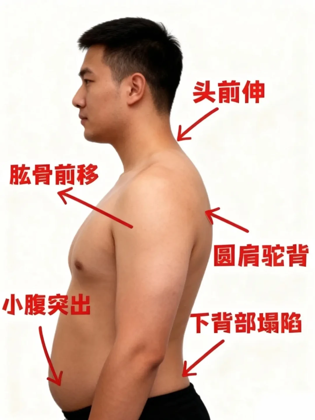 破解体态难题：从根源改善圆肩驼背