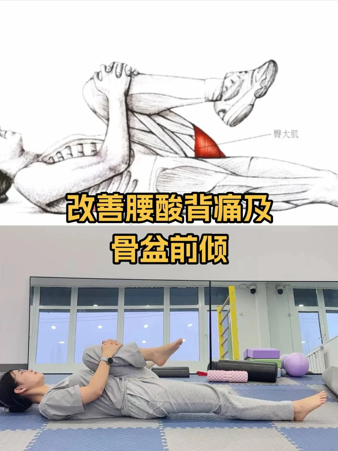 破解体态难题：从根源改善圆肩驼背