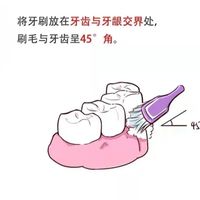 日常口腔护理全攻略：守护一口好牙