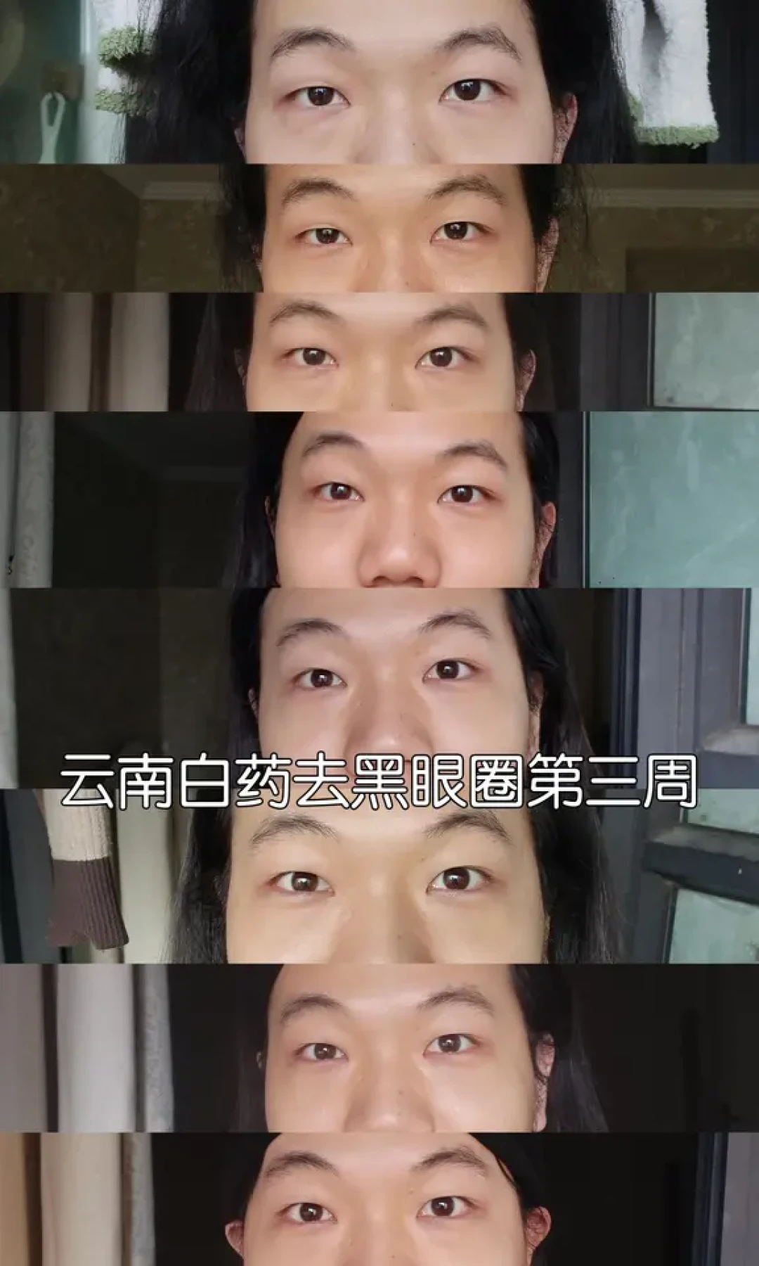 云南白药去眼袋黑眼圈三周实测