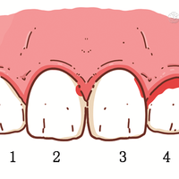 牙线使用误区与正确方法解析