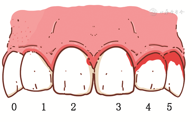 牙线使用误区与正确方法解析