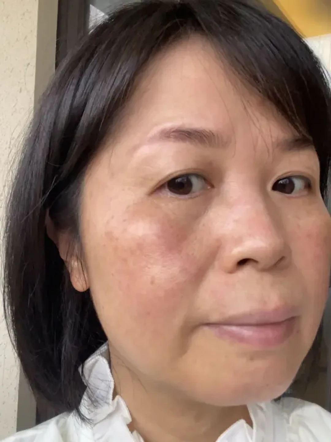 告别敏感肌:从根源调理屏障受损肌肤