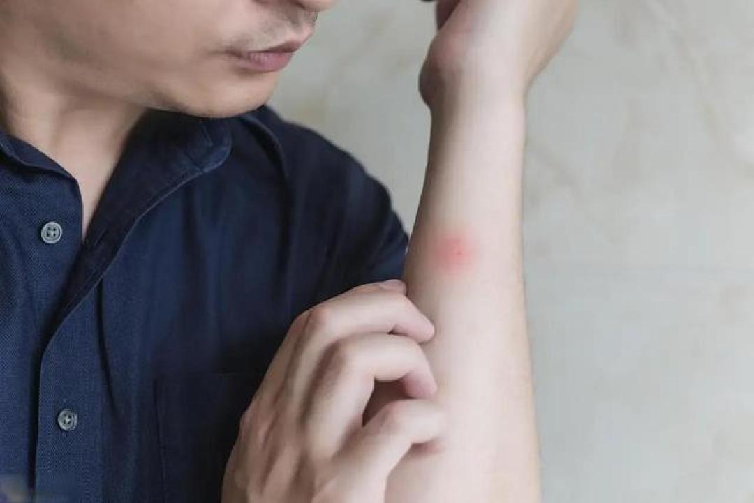多名院士呼吁:尽量停止使用电热毯,否则可能会诱发3种疾病?