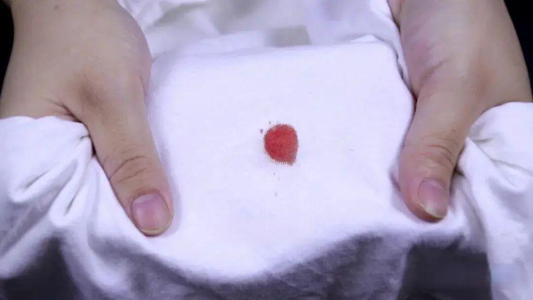 不管衣服裤子上的血渍多顽固,教你简单方法,新老血渍一搓就掉