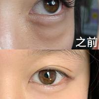 绝不踩雷！成分党教你3步看清眼精华值不值买？（内附德玛森氏 UP21 眼精华测评）