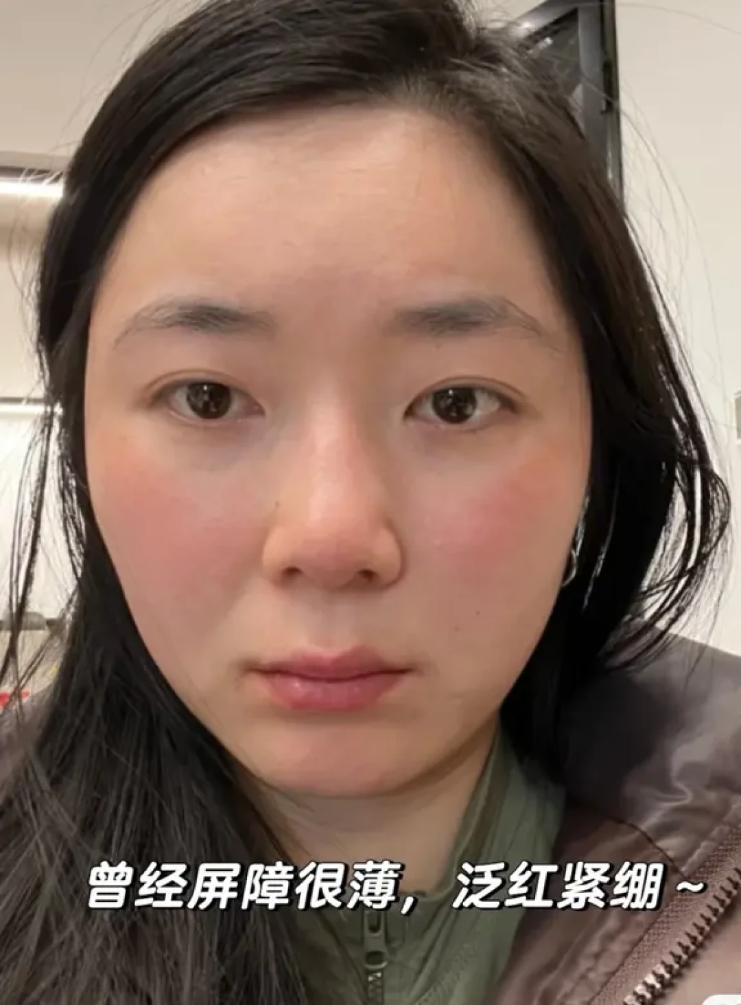 30+护肤尽头是养厚屏障