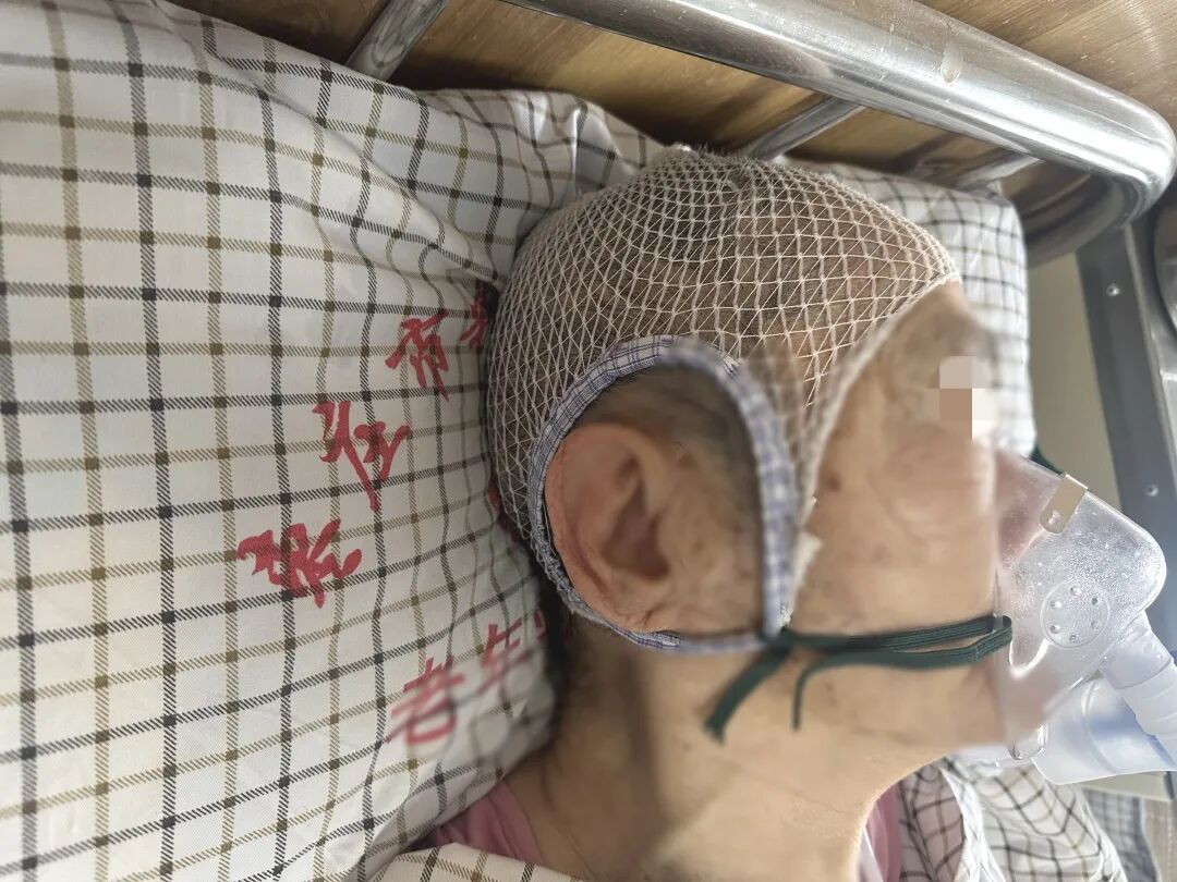 一根松紧带的智慧：头套里的暖心护理
