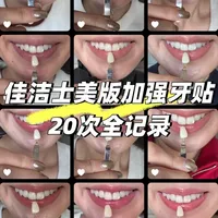 佳洁士美版加强牙贴超详细记录合集