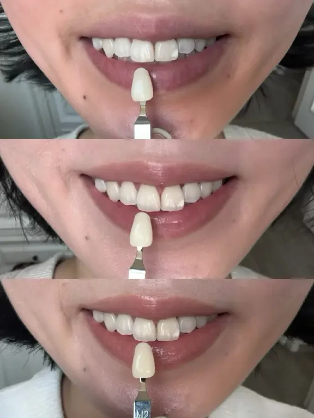 佳洁士美版加强牙贴超详细记录合集