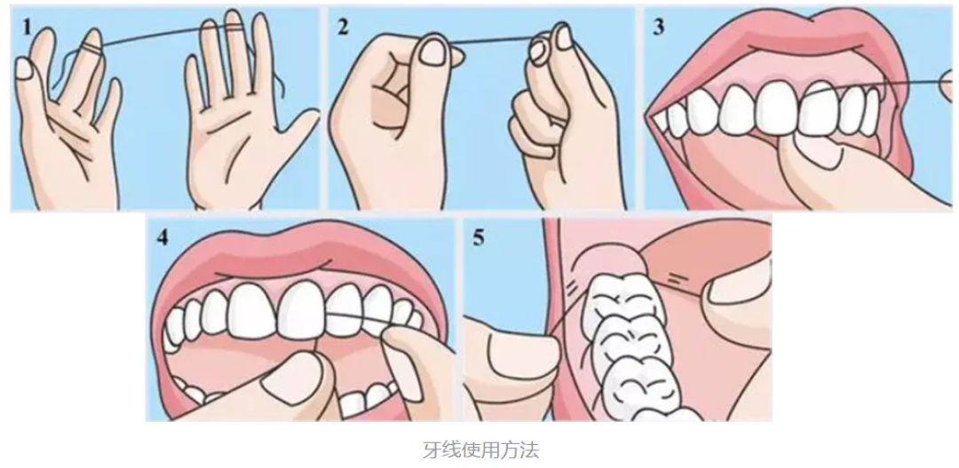 PMTC:口腔健康的“深度大扫除”
