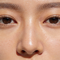 混合性肌肤的科学护理指南